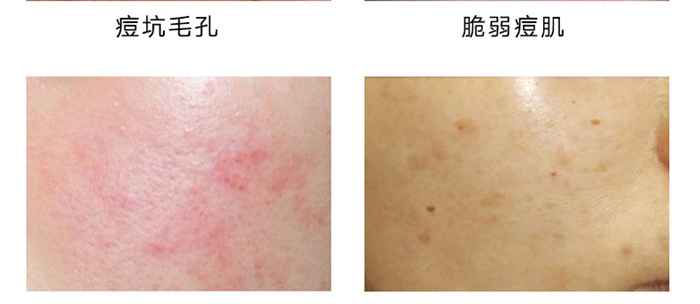 ���B(y��ng)���������o(h��)��